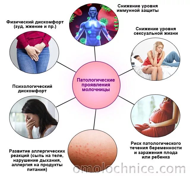 Почему молочница у женщин причины. Профилактика при кандидозе. Профилактика кандидоза у женщин. Памятка профилактика кандидоза.