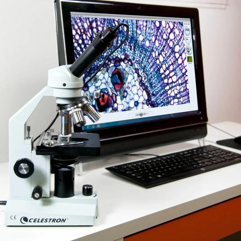 Микроскоп с монитором. Микроскоп цифровой &quot; celestron&quot;. видеоокуляр микромед dcm130e. цифровая камера для микроскопов celestron. цифровой микроскоп digital microscope.