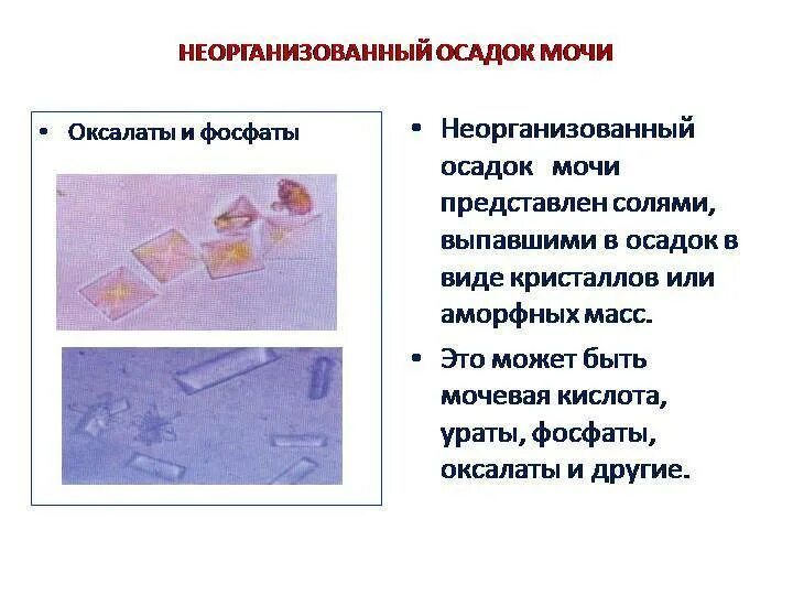 Фосфаты в какой моче. Оксалаты кальция в осадке мочи. Оксалаты фосфаты Ураты в моче. Соли оксалаты в моче. Оксалаты и фосфаты в моче.