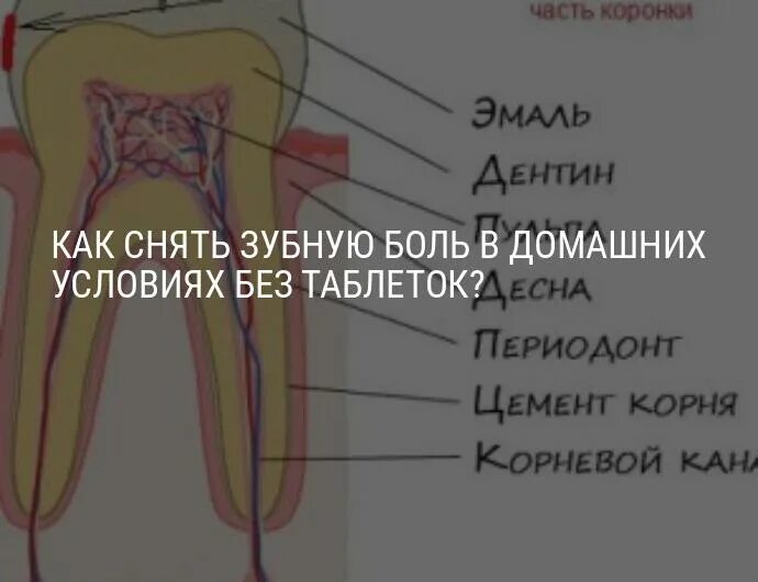 Как удалить зубную в домашних условиях. Как устранить боль в зубах. Для зубная боль домашних условиях.