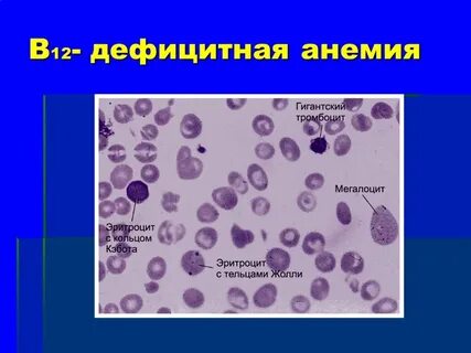 Патология форменных элементов
