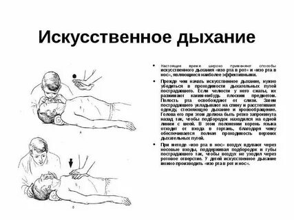 3 искусственное дыхание