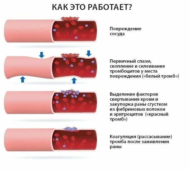 Сосудистый механизм свертываемости крови. Механизмы повреждения стенки сосудов. Тромбоциты повреждение сосуда схема. Методом коагуляции повреждённых сосудов. Тромб норма