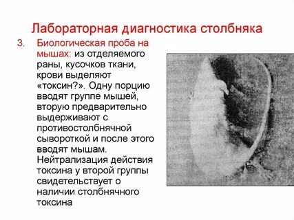 Болит рука после столбняка