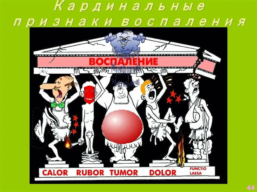 Признак воспаления dolor. 5 Признаков воспаления. Воспаление тумор Рубор. Кардинальные признаки воспаления. Признаки воспаления tumor rubor calor dolor.