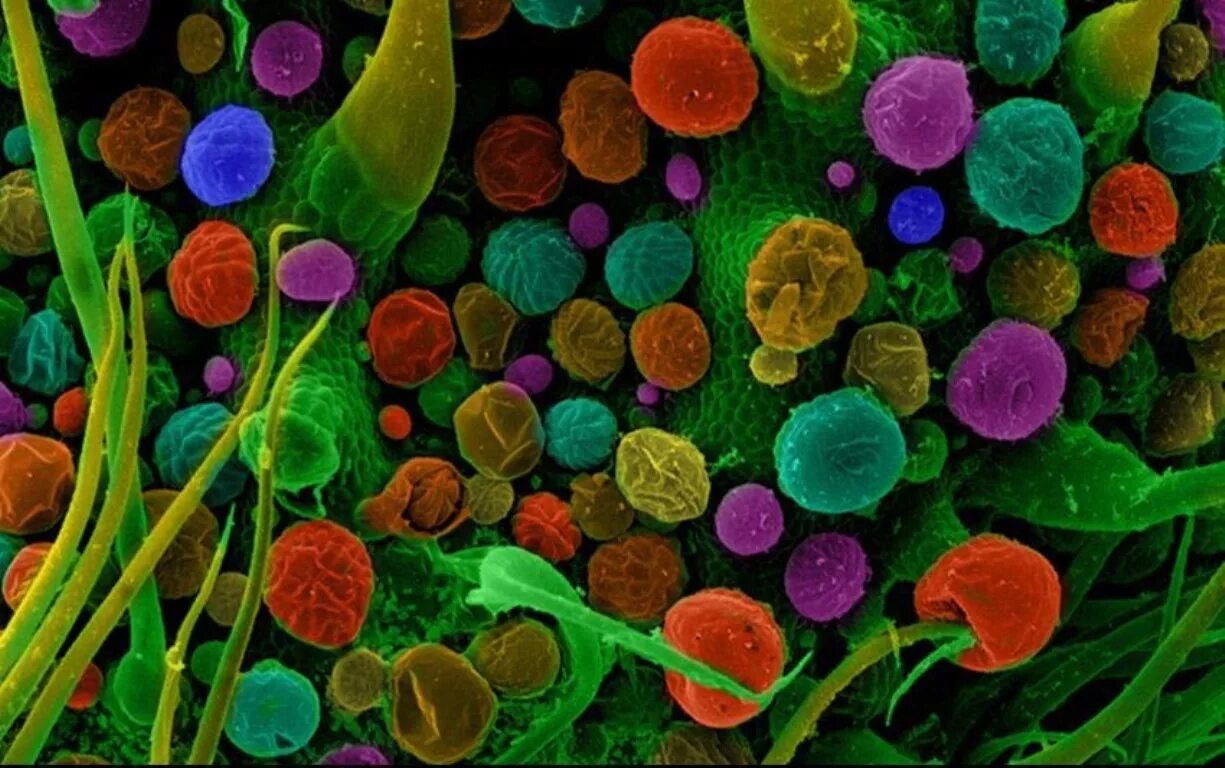 Как выглядят витамины под микроскопом Best Parasitic Infection Stock Photos, Pictures & Royalty-Free Images iStock