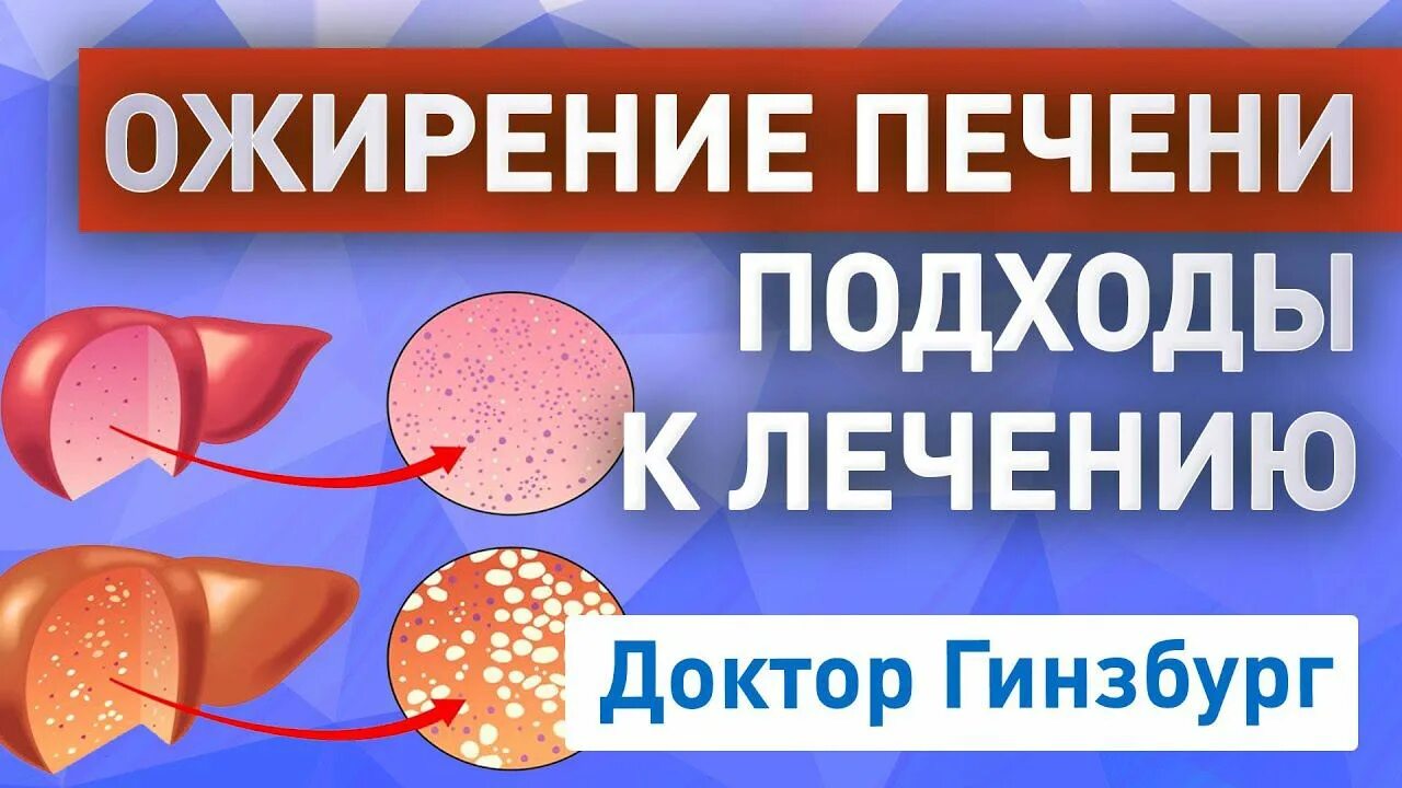 Жировой гепатоз 1 степени. Ожирение печени у женщин после 60. Ожирение печени симптомы. Ожирение печени у женщин после 60. Гепатоз ожирение печени.