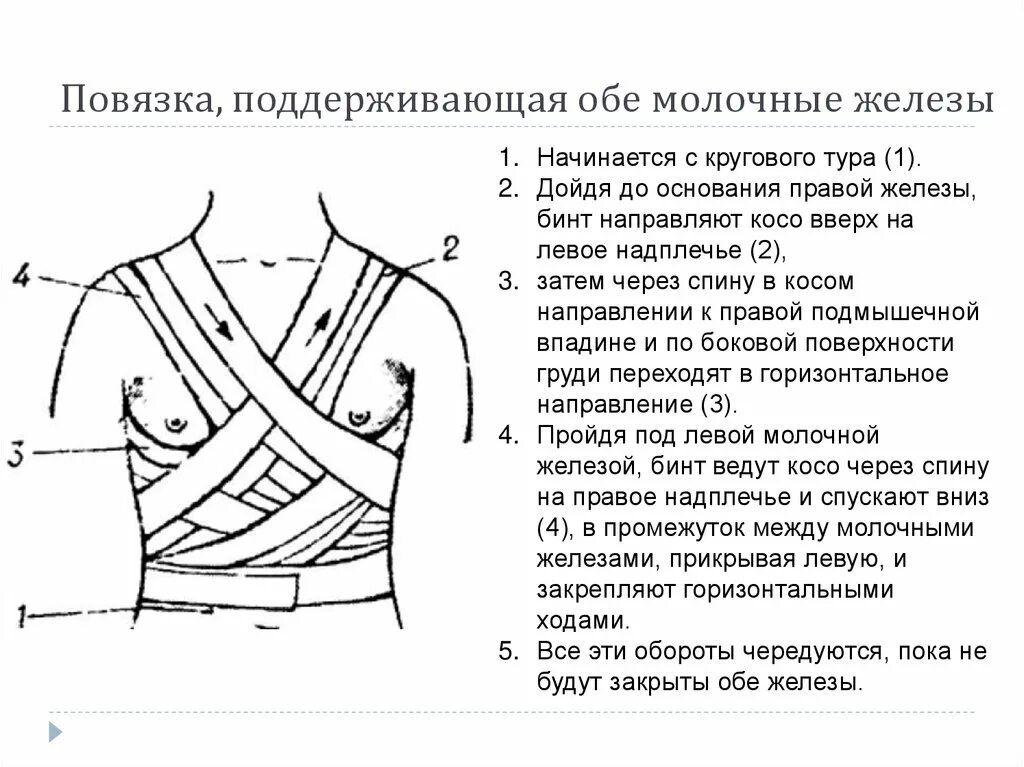 Сколько нужно делать перевязки. Десмургия повязки на грудную клетку. Бинтовая повязка поддерживающая на молочную железу. Наложение поддерживающей повязки на молочную железу. Десмургия повязка на молочные железы.