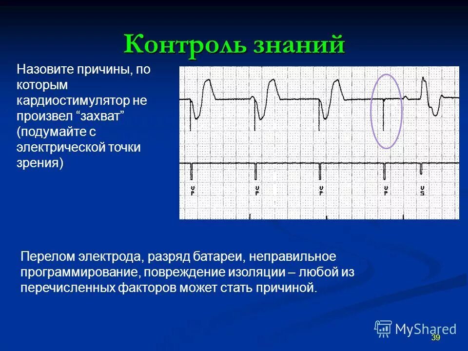 При наличии кардиостимулятора можно. ЭКГ при кардиостимуляторе. Контроль знаний ЭКГ. Двухкамерный кардиостимулятор на ЭКГ. Программирование кардиостимулятора.