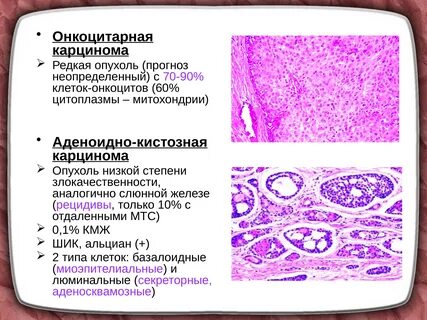 Фокус карциномы