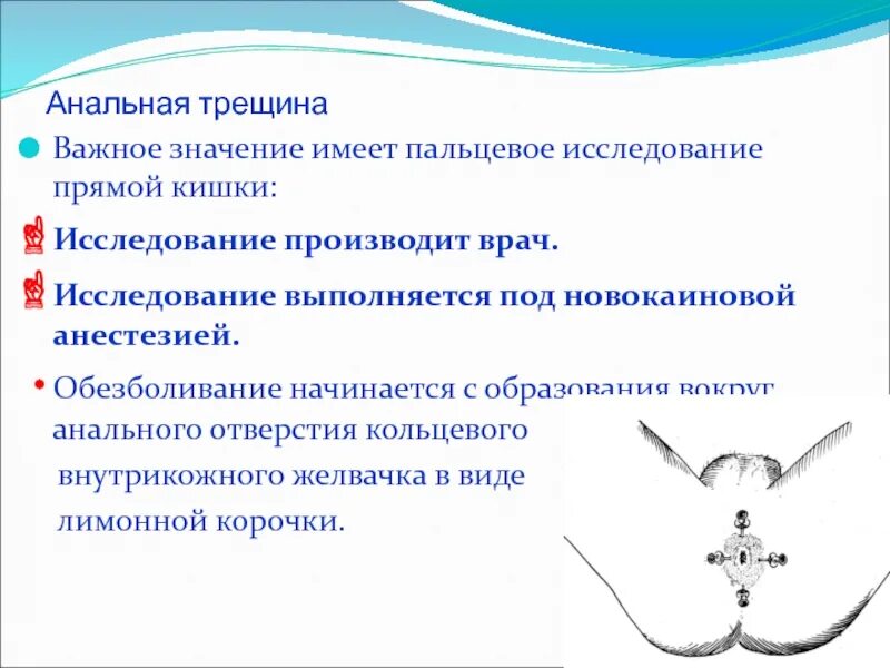 Кол задний проход. Кол задний проход