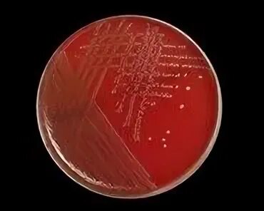 Enterococcus faecalis лечение. Энтерококки на кровяном агаре. энтерококки микробиология. энтерококки faecalis. e. faecalis микробиология.