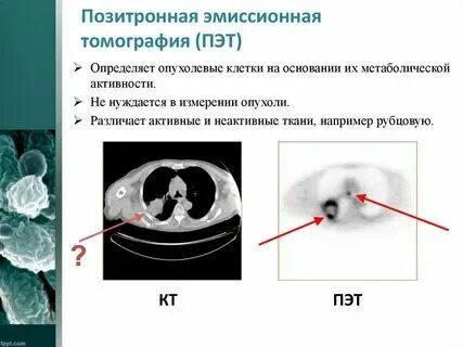 Что такое кт при онкологии. Что такое кт при онкологии