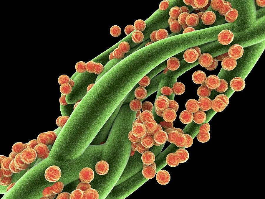 Стафилококк кишечника у взрослых. Золотистый стафилококк mrsa. зеленящий стафилококк. стафилококк золотистый биология.