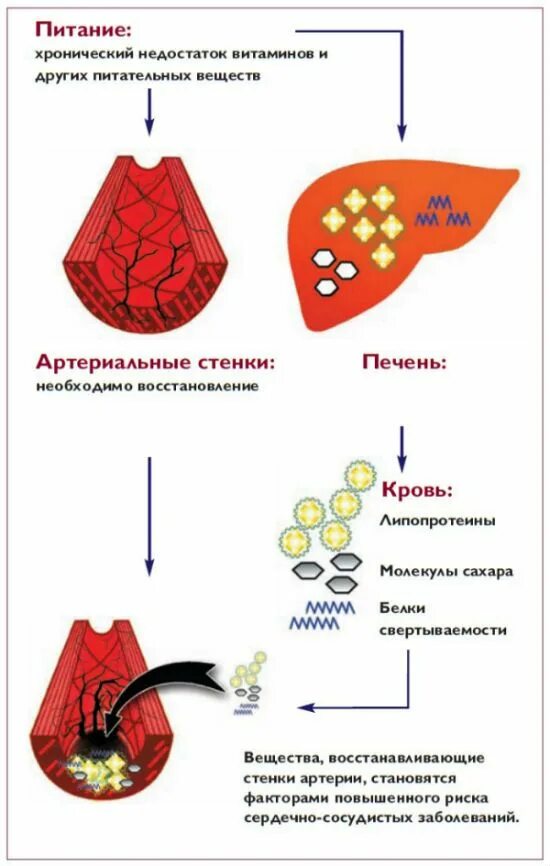 Симптомы повышенного холестерина. Холестерин повышен симптомы. Холестерин кратко. Холестерин группа веществ. Памятка по холестерину.