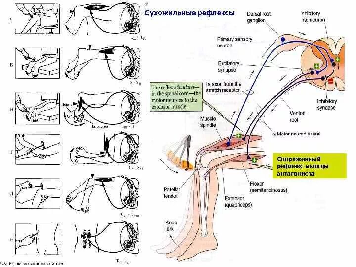 Рефлексы мышц. Рефлекторная дуга сухожильного рефлекса. Сухожильный рефлекс схема. Глубокие рефлексы неврология схема. Исследование кожных и сухожильных рефлексов.