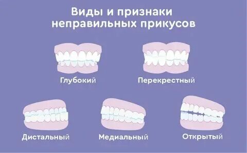 Как правильно исправить прикус