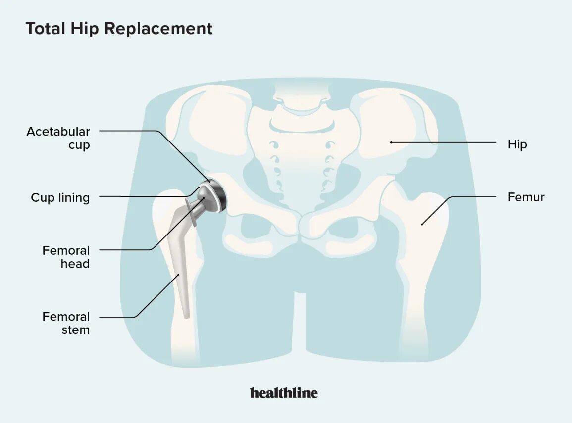 Hip z. Hip joint rehabilitation. Тазобедренный сустав 3 д. Hip z. Low hip.