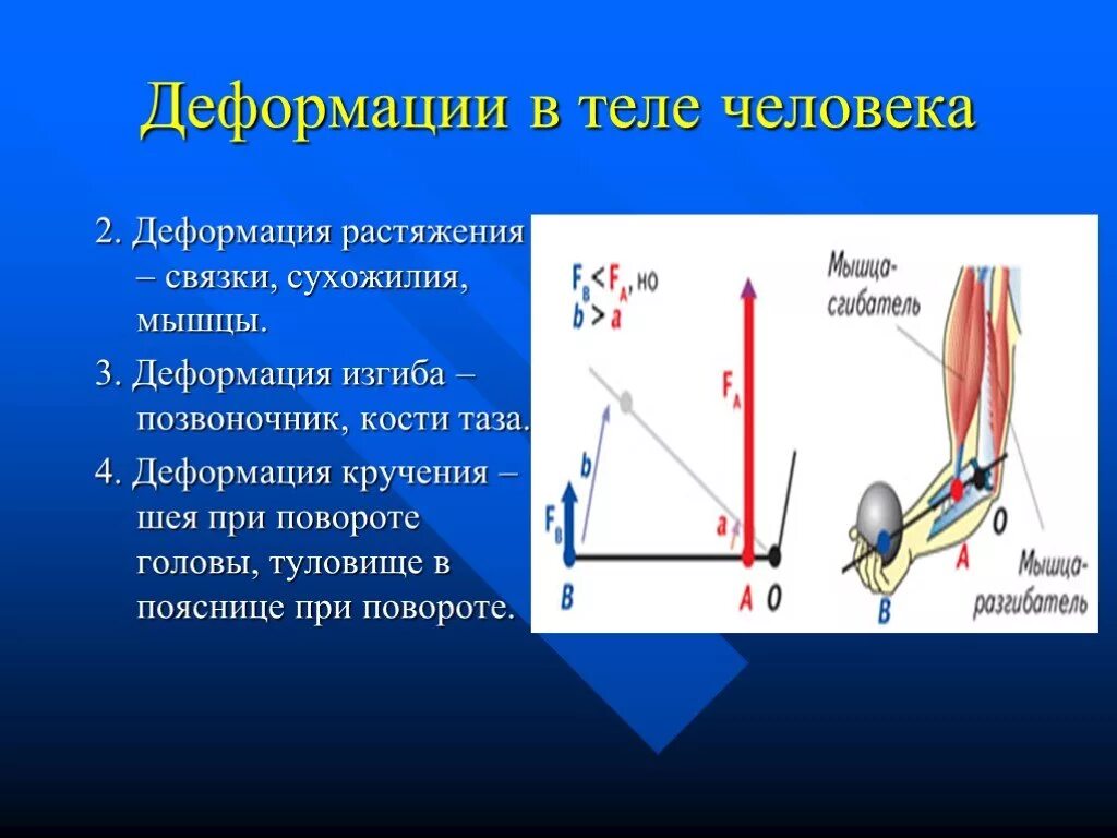 Закон физики тело. Деформация в теле человека. Деформация в человеческом теле. Виды деформации в теле человека.