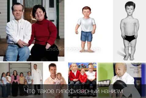 Карликовость недостаток