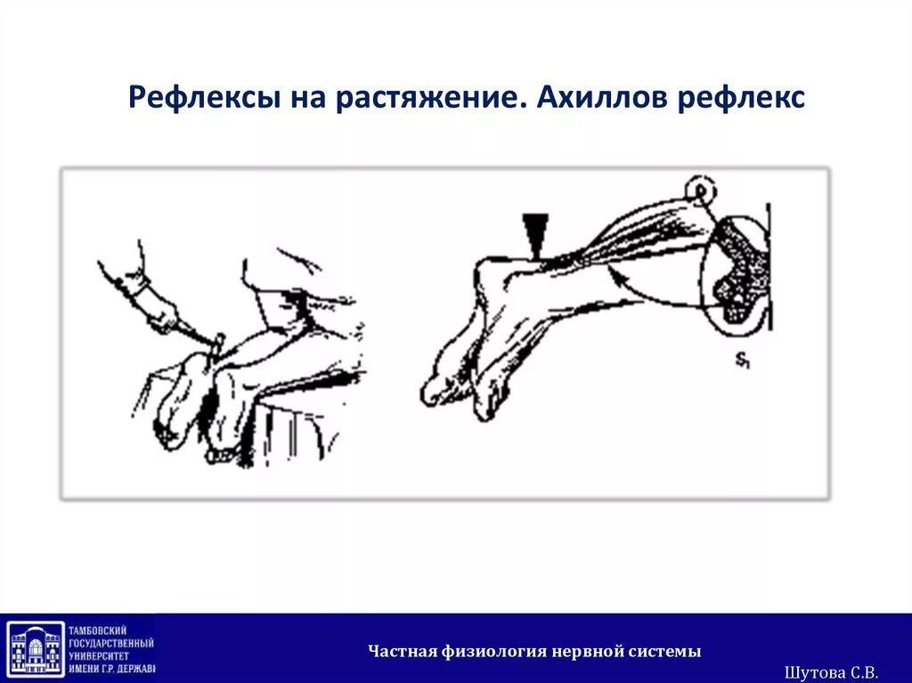 Угасание рефлексов. Рефлекторная дуга ахиллова рефлекса рефлекса. Схема ахиллового рефлекса физиология. Пяточный (Ахиллов) рефлекс. Ахиллов рефлекс физиология дуга.