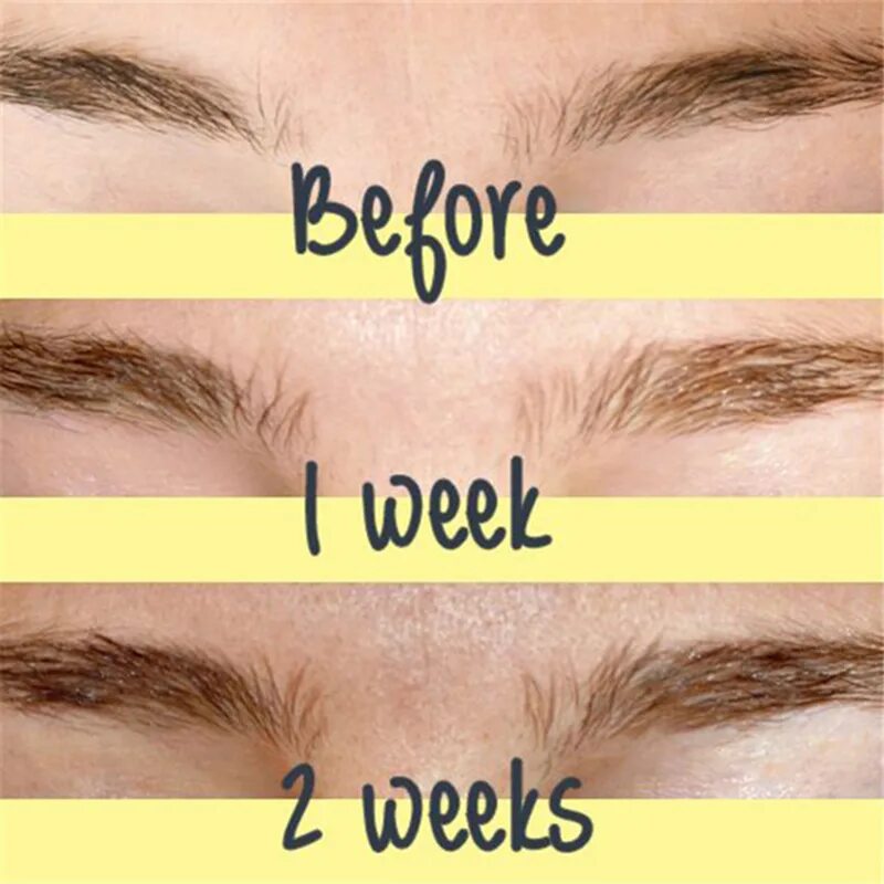Brow growth. Brow growth. Brow growth. Brow growth. Brow growth.