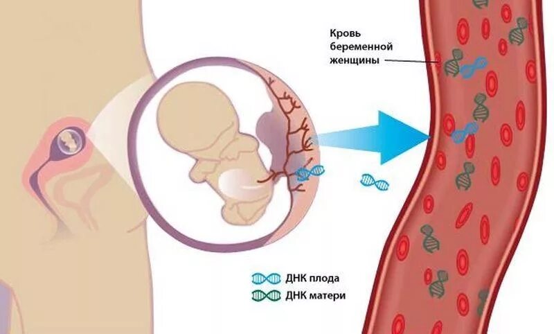 ДНК плода в крови матери. Методы пренатального скрининга. Генетические аномалии плода. Неинвазивный пренатальный скрининг. Днк на материнство