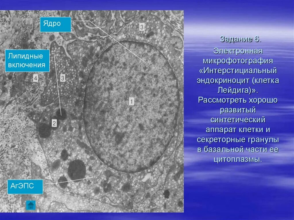 На электронных микрофотографиях в клетках временных