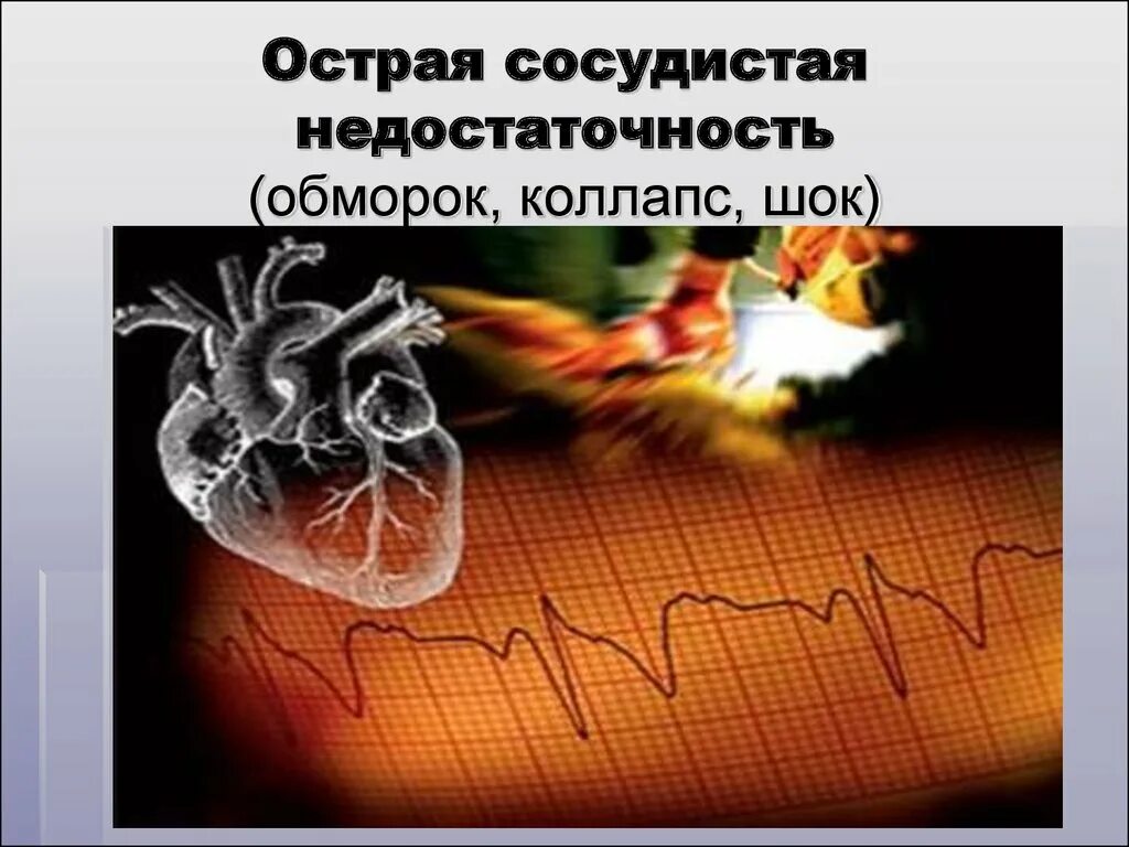 Острая сосудистая недостаточность коллапс. Острая сосудистая недостаточность презентация. Острая сосудистая недостаточность обморок. Острая сосудистая недостаточность обморок коллапс. Острое сердечное нарушение