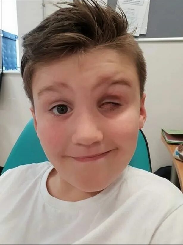 Глаза мужские. Девушка без одного глаза. Глаза мужские. Лицо без одного глаза. Брови человека.