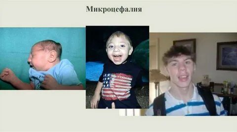 Черепной дети