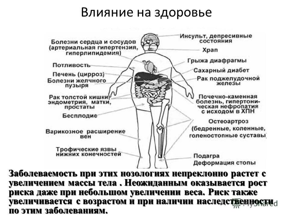 Влияние ожирения на организм. Влияние избыточного веса на организм. Влияние избыточного веса на здоровье. Влияние болезни на организм.