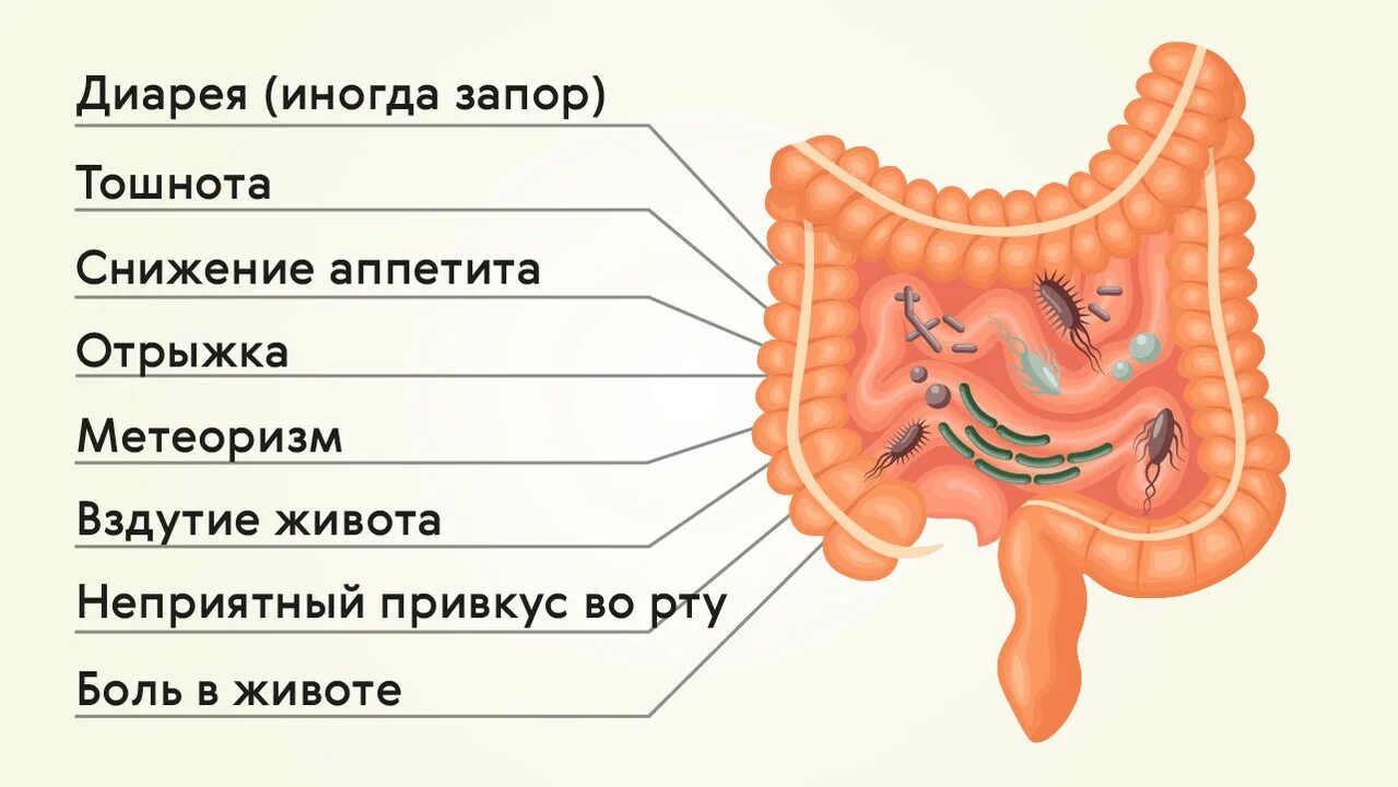 Нарушение микрофлоры кишечника симптомы. Бактериоз кишечника. дисбактериоз кишечника симптомы. дисбактериоз тонкой кишки. дисбактериоз толстой кишки.