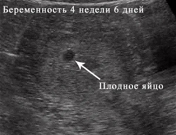 4 недель беременности размер
