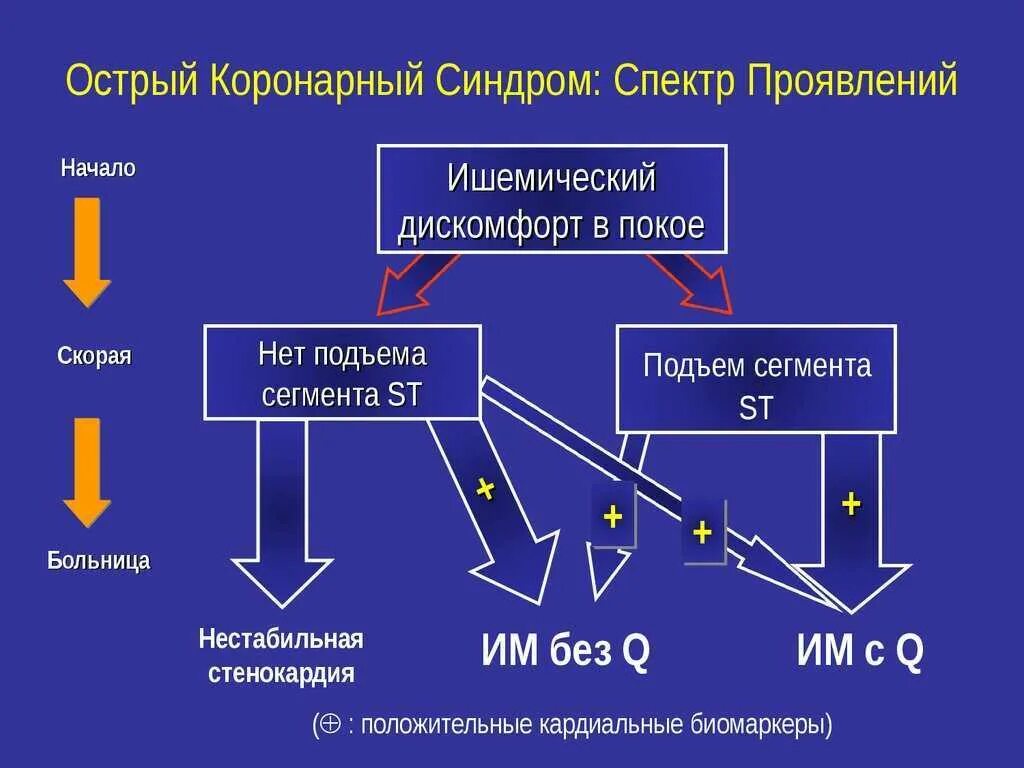 Окс клинические рекомендации 2023. Острый коронарный синдром классификация. Острый коронарный синдром клиническая картина. Симптомы при остром коронарном синдроме. Острый коронарный синдром сердце.