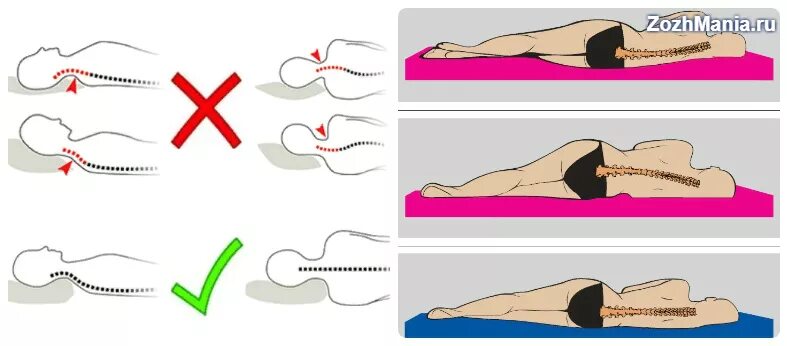 Остеохондроз спать без подушки. Спать без подушки. Спать на спине без подушки. Подушка для исправления осанки. Правильная поза для сна.
