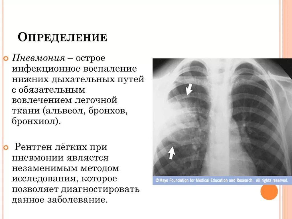 Где проверяют легкие