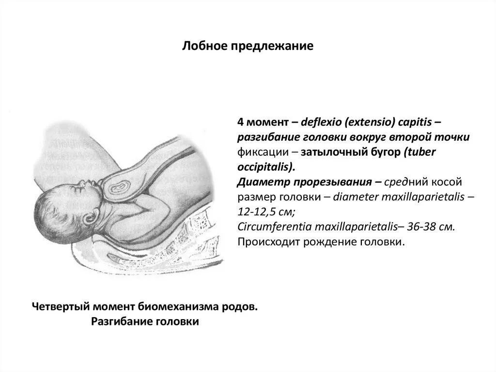 Предлежание головки. Биомеханизм родов при лобном предлежании. лобное предлежание плода биомеханизм родов. лобное вставление головки плода в родах. лобное предлежание плода проводная точка.