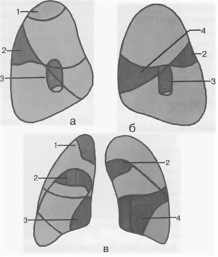 Легкое строение анатомия. Легочная плевра анатомия. Кт грудной клетки аксиальный срез анатомия. Висцеральная и париетальная плевра. Базальные отделы легких на кт.