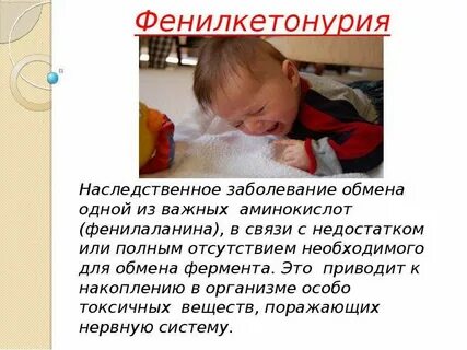 Синдром фенилкетонурия