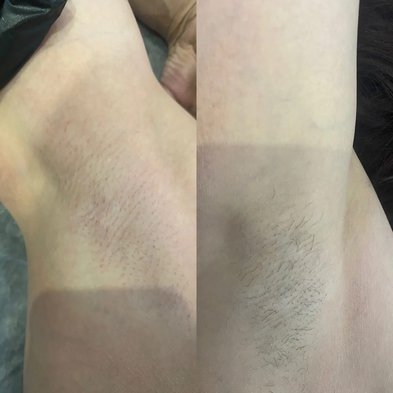 Гладкие ноги. Депиляция 2023. Лазерная эпиляция все тело. Эпиляция 2023. Эпиляция 2023.