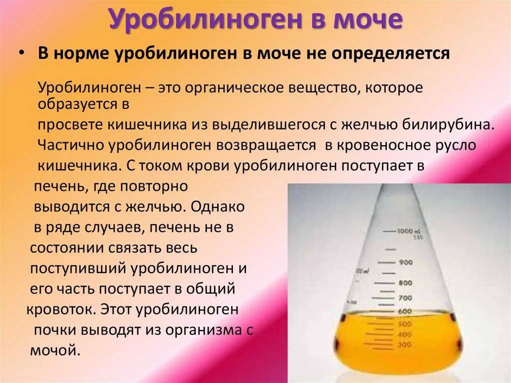 Повышенное количество мочи. Уробилиноген в моче. Уробилин в моче. Уробилин в моче повышенный. Повышение уробилиногена в моче.