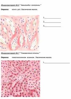 Селезенка микропрепарат