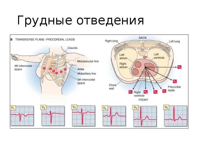 Грудные отведения. Отведения грудные отведения. Грудные отведения и стенки сердца. Грудные отведения стенки. Правые грудные отведения