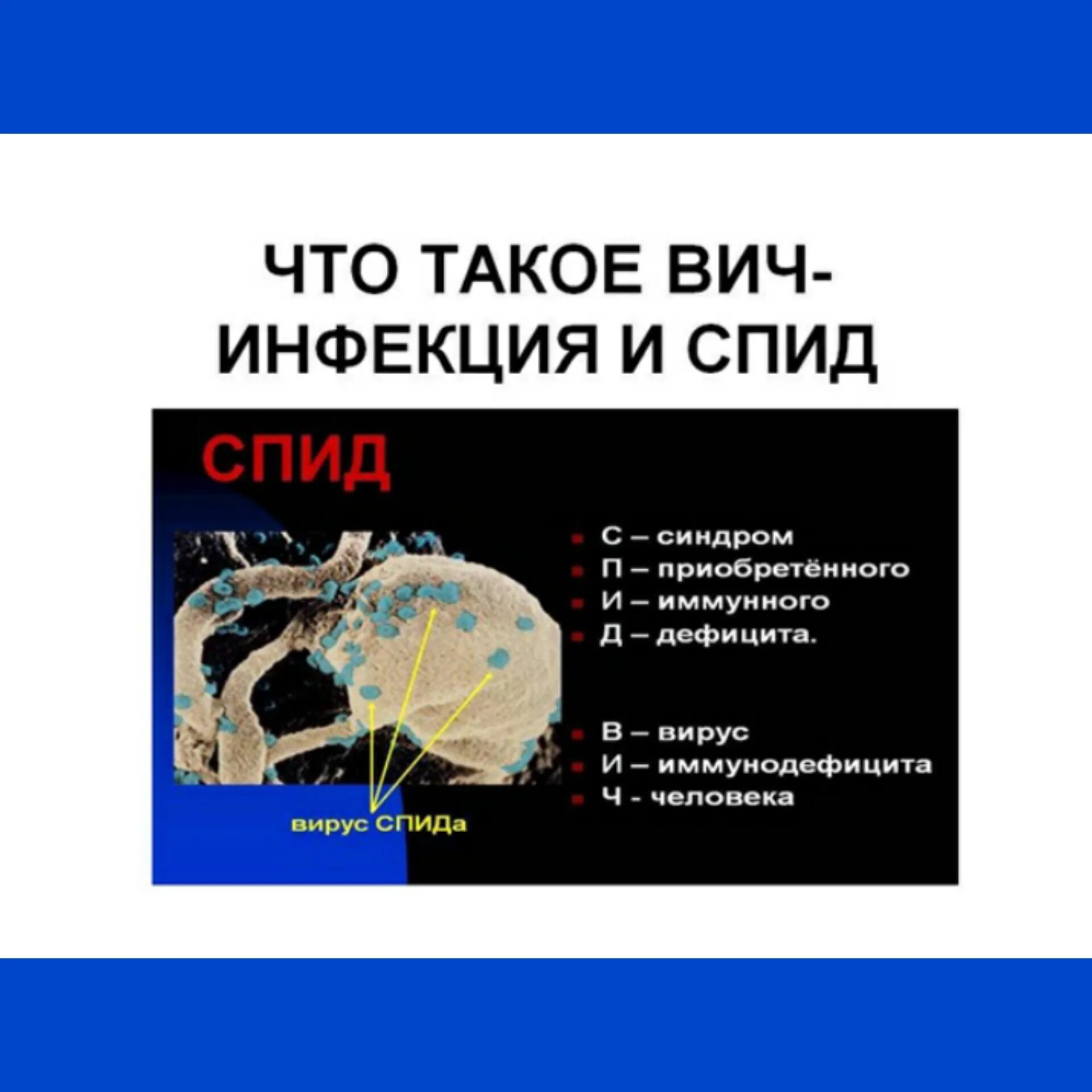 Как расшифровывается вич. Презентация на тему ВИЧ. Расшифровка ВИЧ И СПИД. СПИД аббревиатура.