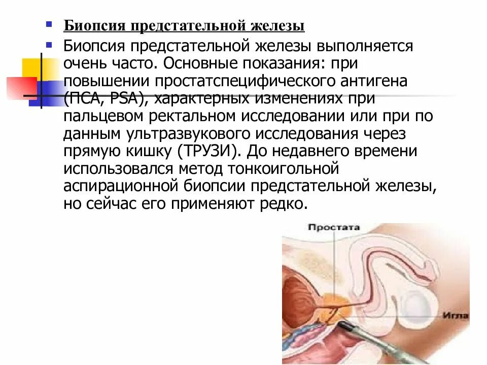 Биопсия простаты отзывы