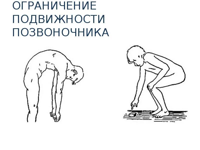 Ограничение человека в передвижении. Ограничения подвижности позвоночника. ограничение движений в позвоночнике. ограничение подвижности в пояснице. мобильность поясницы.
