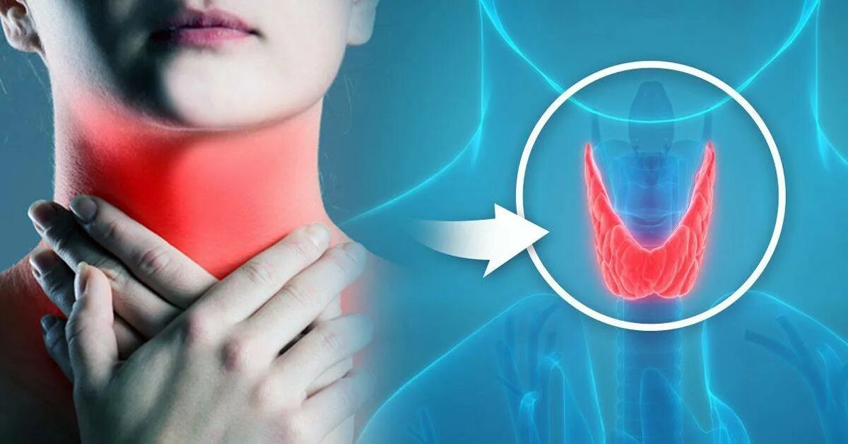 Психосоматика узлов щитовидной железы. Заболевания щитовидной железы. Здоровая щитовидная железа.