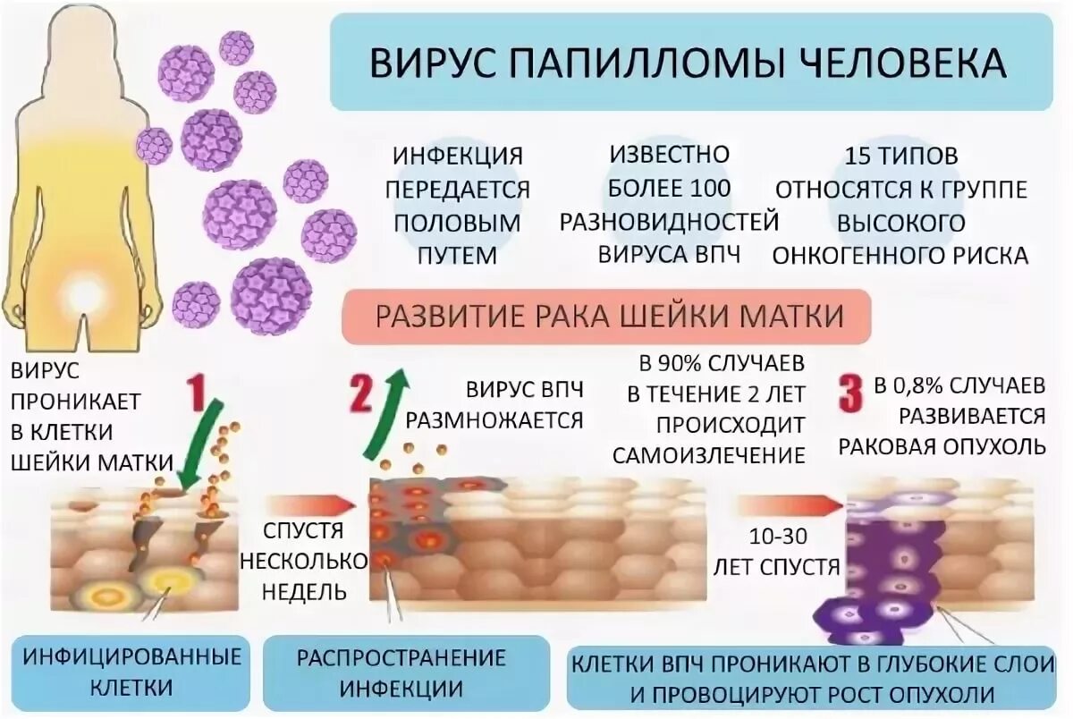 Впч как называется