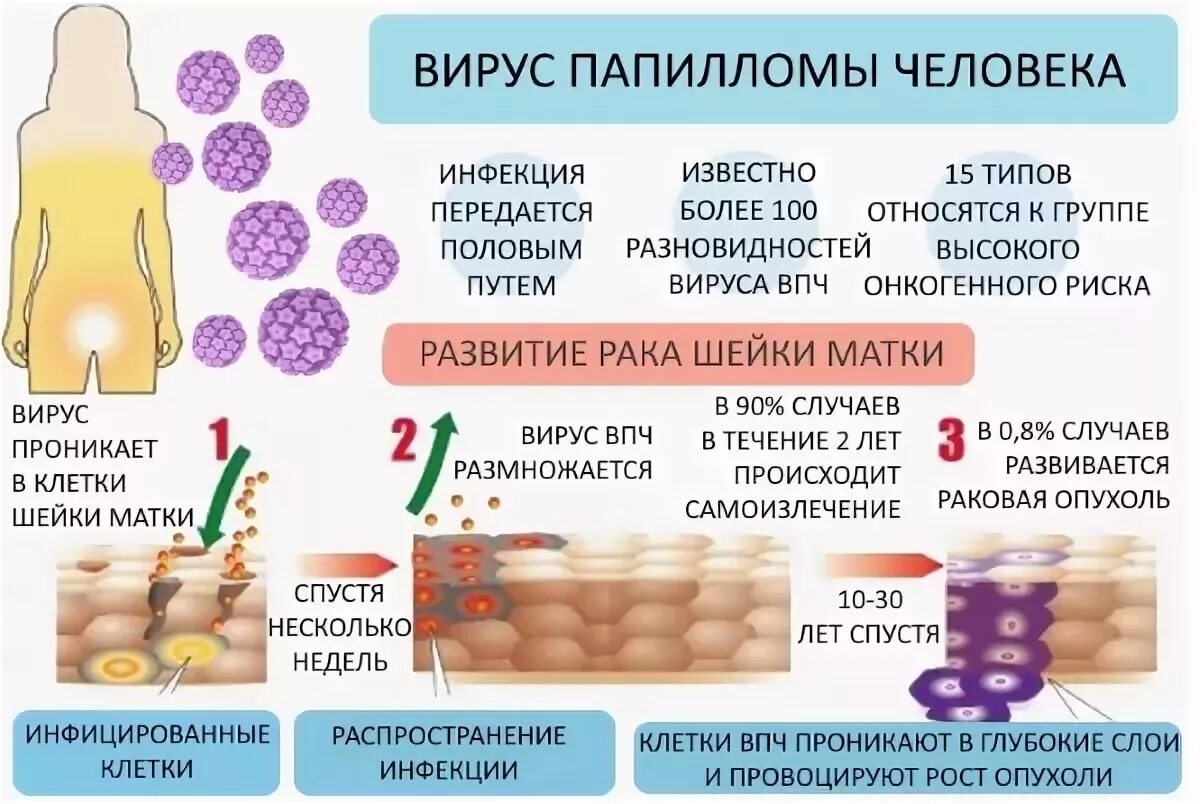 Заболевания передающиеся вирусами